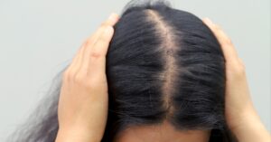 hair fall control shampoos