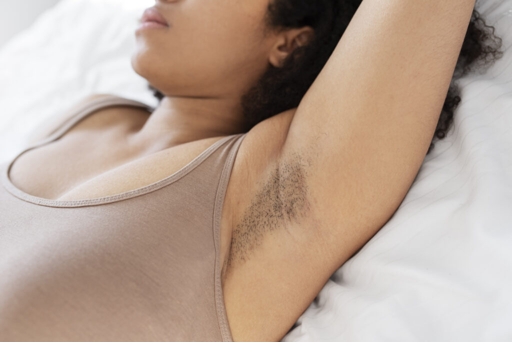 causes of dark underarms and intimate areas
