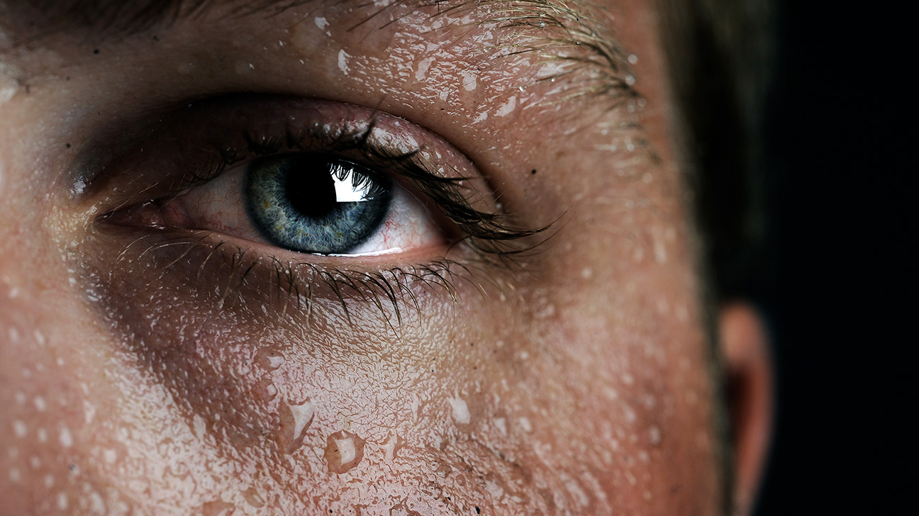 What Is Sweat and Why Do We Sweat?